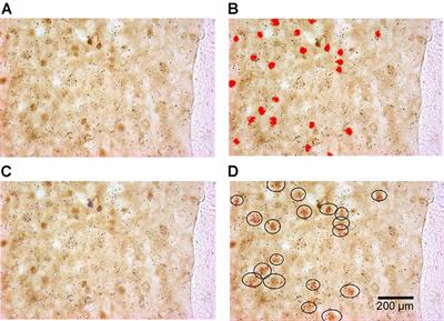 Differential Expression of DeltaFosB in Reward Processing Regions Between Binge Eating Prone and Resistant Female Rats